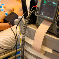 ACLS Advanced Cardiovascular Life Support