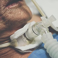 Prise en charge du-de la patient-e trachéotomisé-e