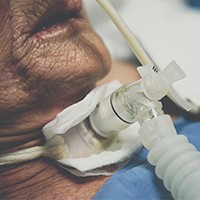 Prise en charge du-de la patient-e trachéotomisé-e